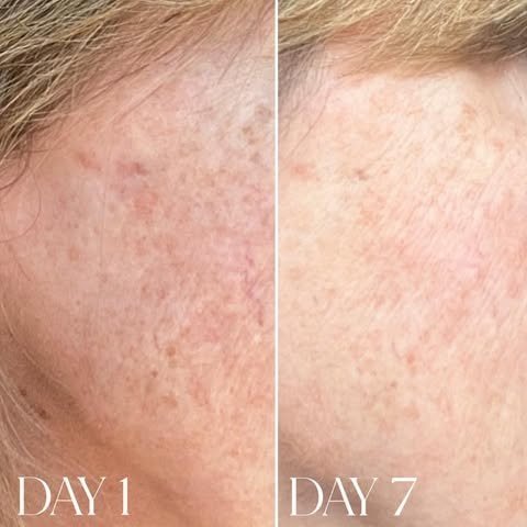 rich night moisturizer for clearer skin overnight