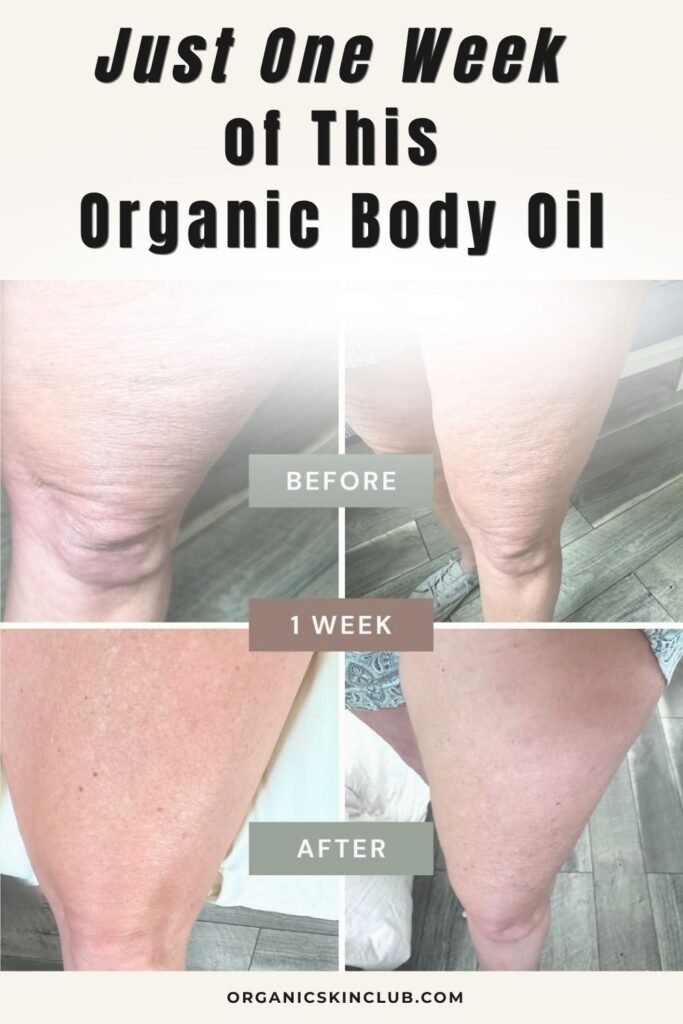 Best organic body oil before and after: leg skin texture improvement in one week with Crunchi body treatment
